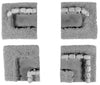 Entrenchment Set Two (15mm)